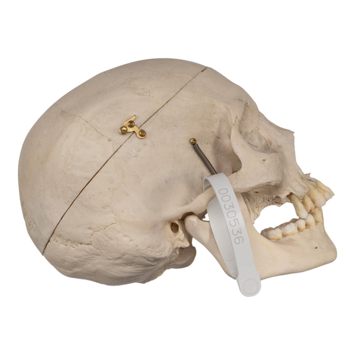 Real Human Skull - Exposed Dentition