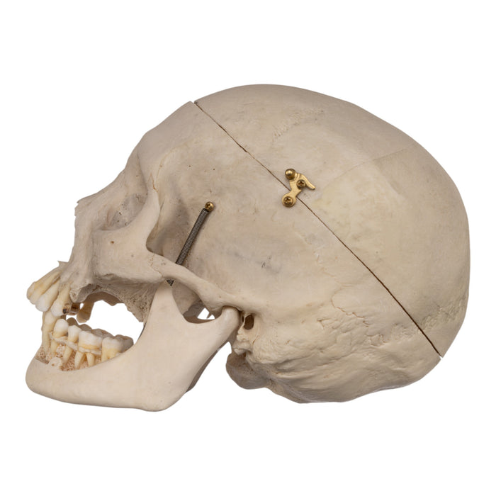 Real Human Skull - Exposed Dentition