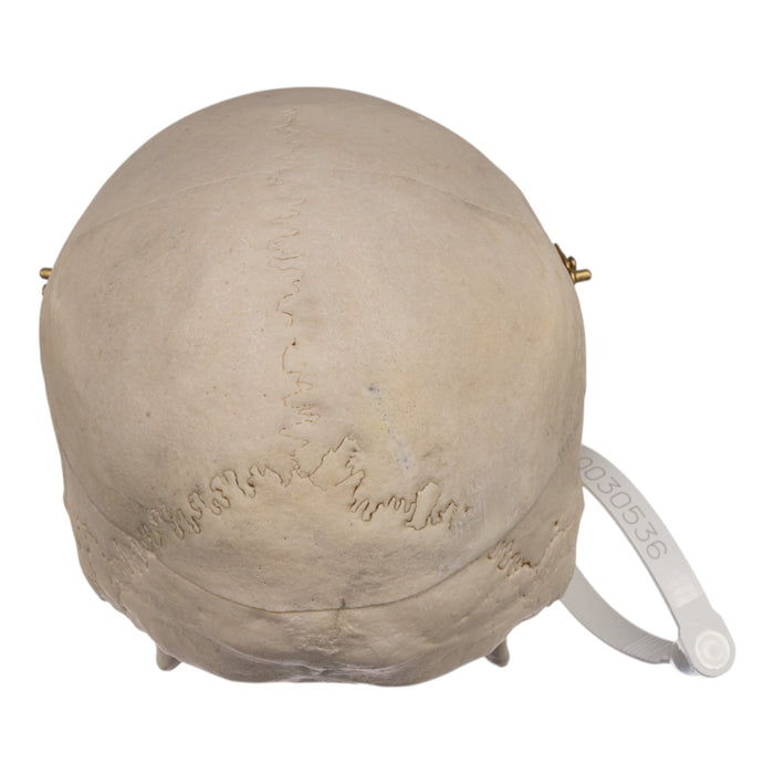 Real Human Skull - Exposed Dentition