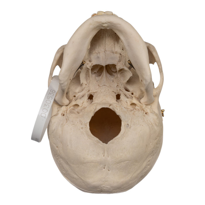 Real Human Skull - Exposed Dentition
