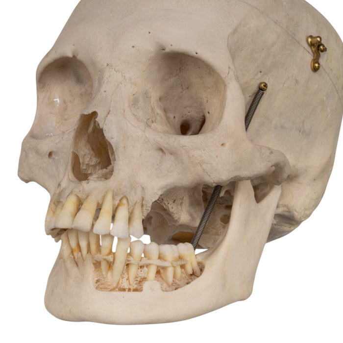 Real Human Skull - Exposed Dentition