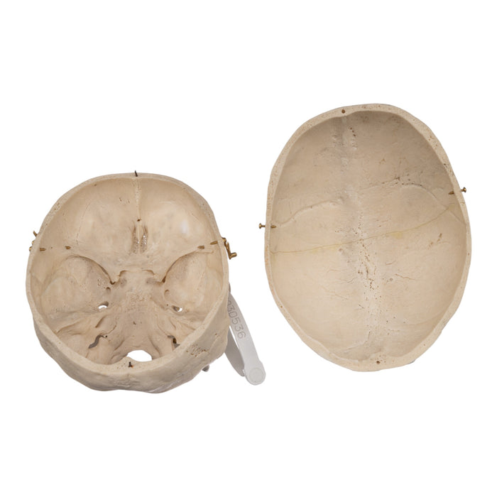Real Human Skull - Exposed Dentition