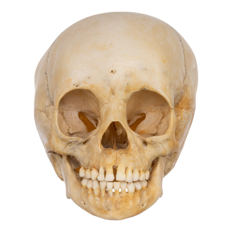 Real Human Child Skull