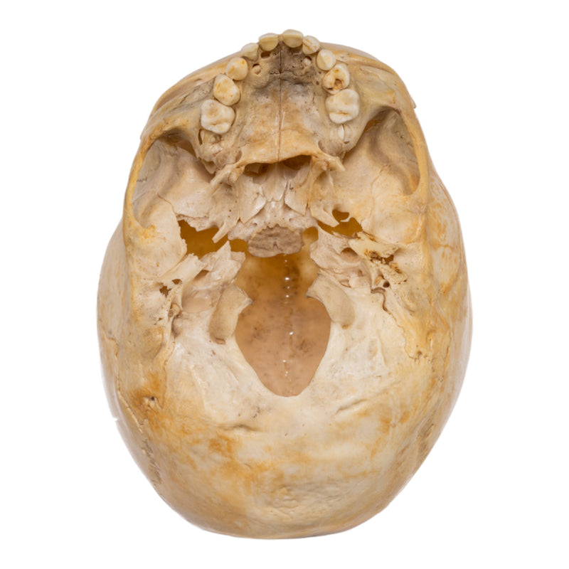 Real Human Child Skull