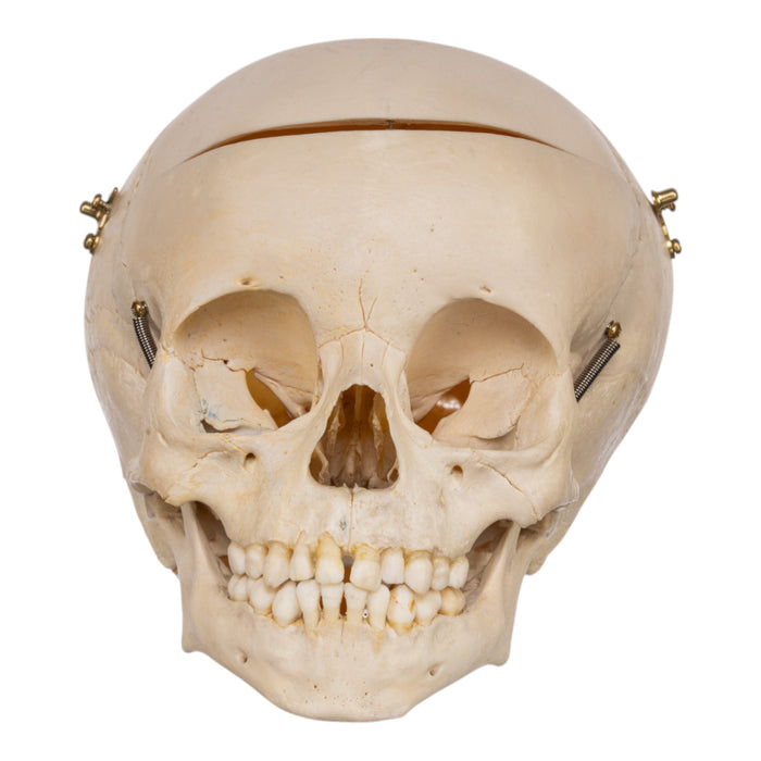 Real Human Child Skull