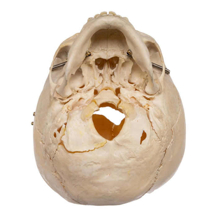 Real Human Child Skull