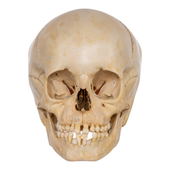 Real Human Child Skull