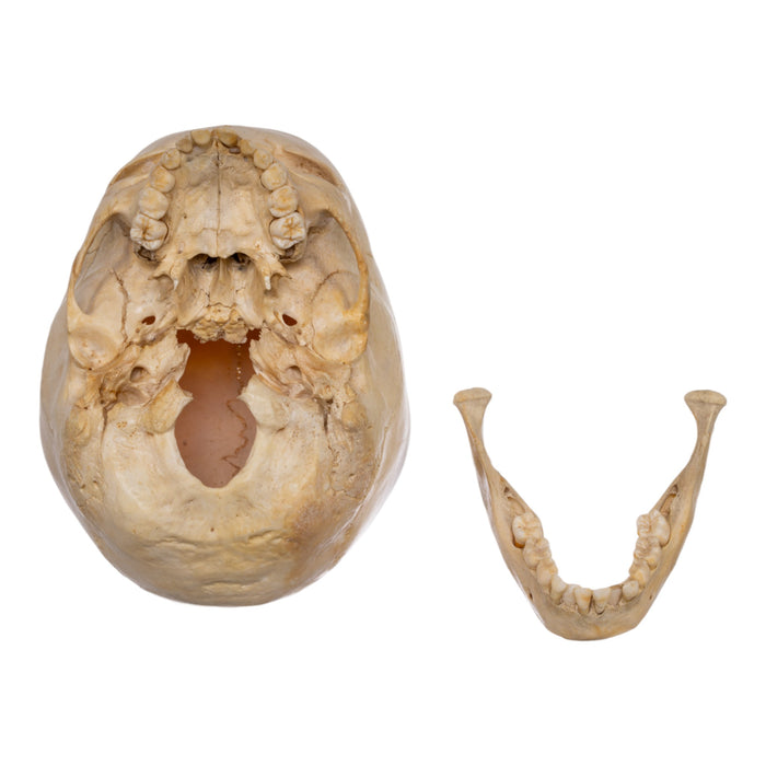 Real Human Child Skull