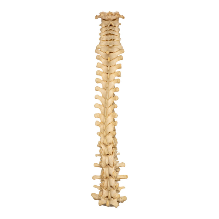 Real Human Spine - Loosely Strung