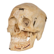 Real Human Skull - Dissected
