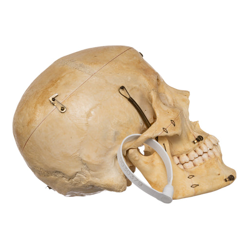 Real Human Skull - Dissected
