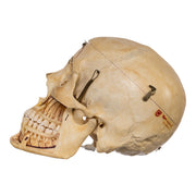 Real Human Skull - Dissected