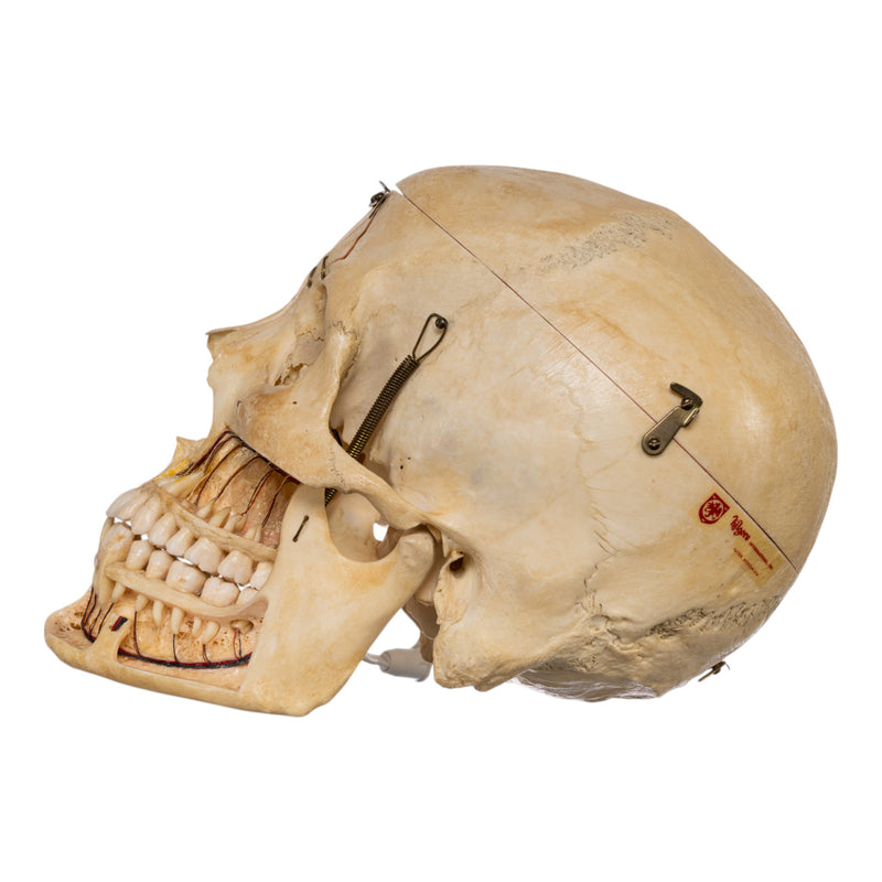 Real Human Skull - Dissected