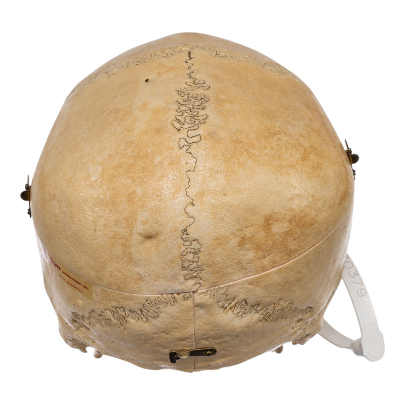 Real Human Skull - Dissected