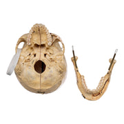 Real Human Skull - Dissected