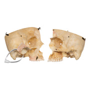 Real Human Skull - Dissected