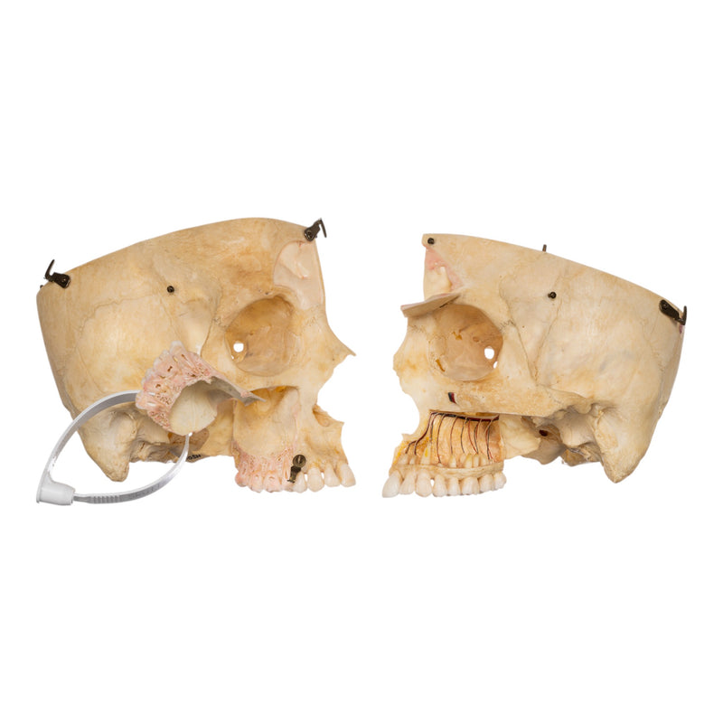 Real Human Skull - Dissected