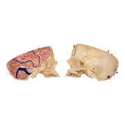 Real Human Skull - Dissected