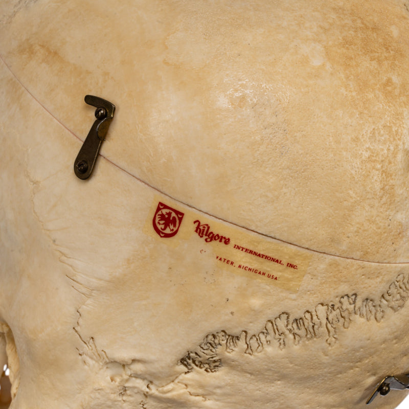 Real Human Skull - Dissected