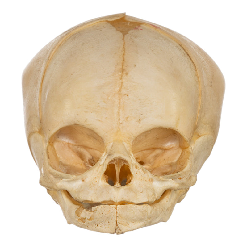 Real Human Fetal Skull