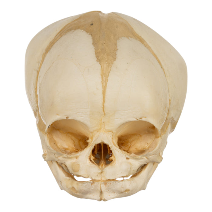 Real Human Fetal Skull
