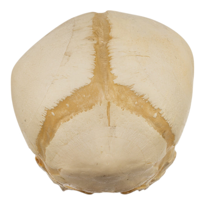 Real Human Fetal Skull