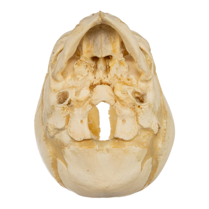 Real Human Fetal Skull