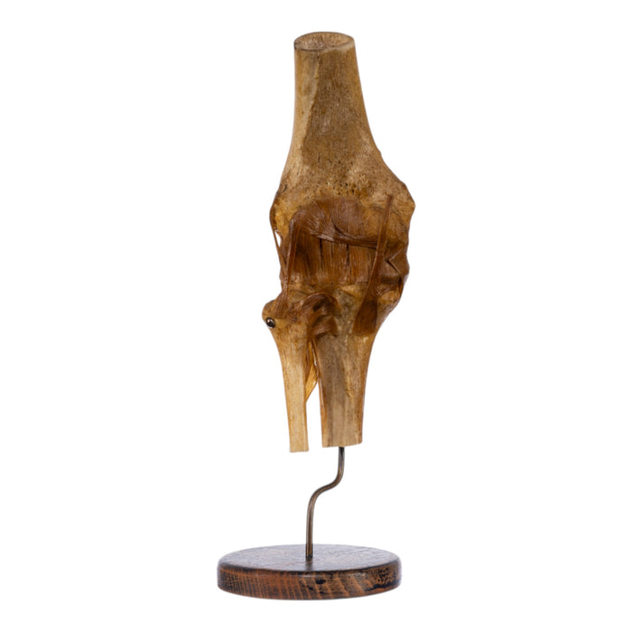 Real Human Knee Joint on Stand