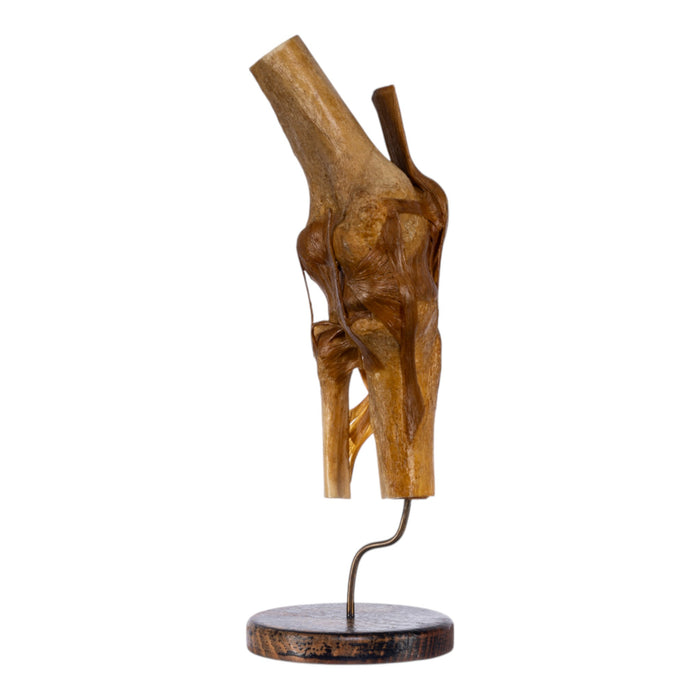 Real Human Knee Joint on Stand
