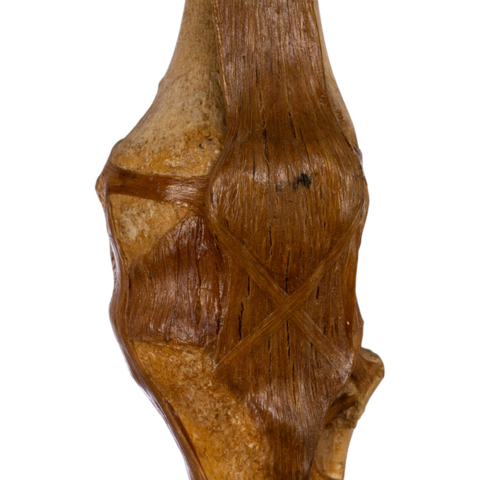 Real Human Knee Joint on Stand