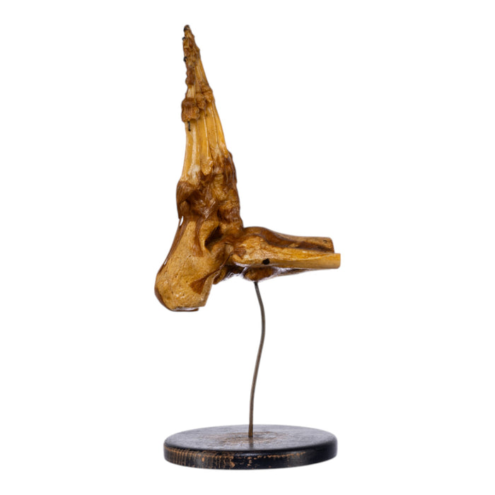 Real Human Foot and Ankle Joint on Stand