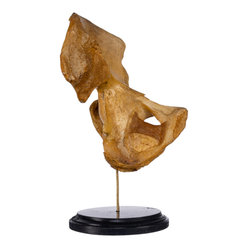 Real Human Left Hip Joint on Stand