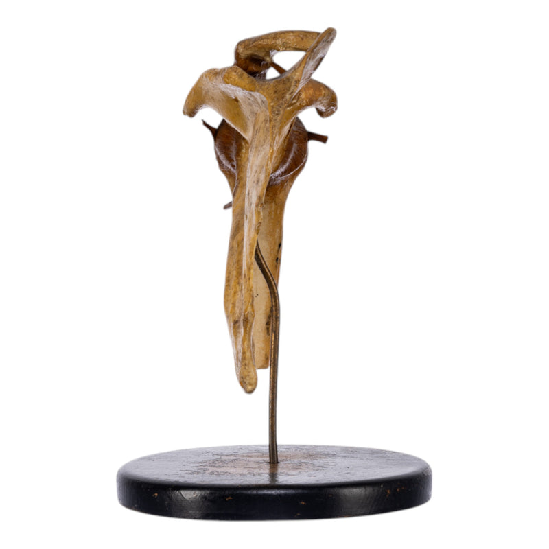 Real Human Left Shoulder Joint on Stand