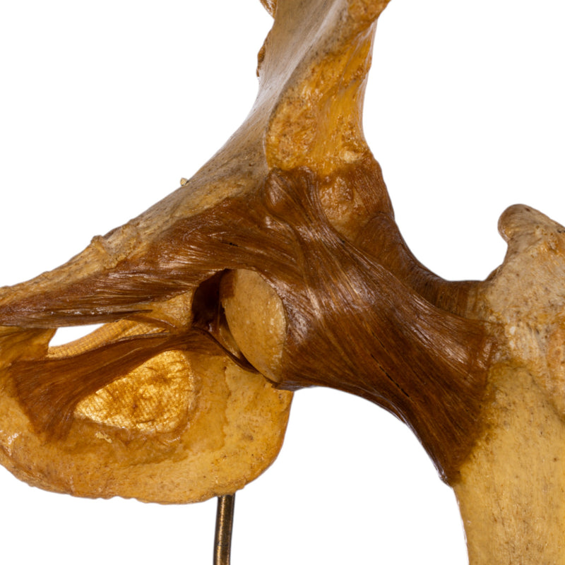 Real Human Left Hip Joint on Stand