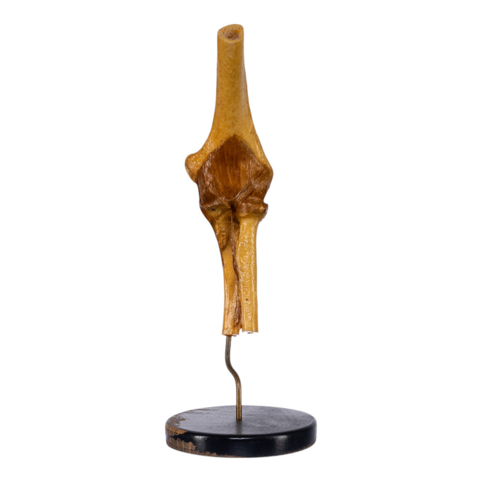 Real Human Elbow Joint on Stand