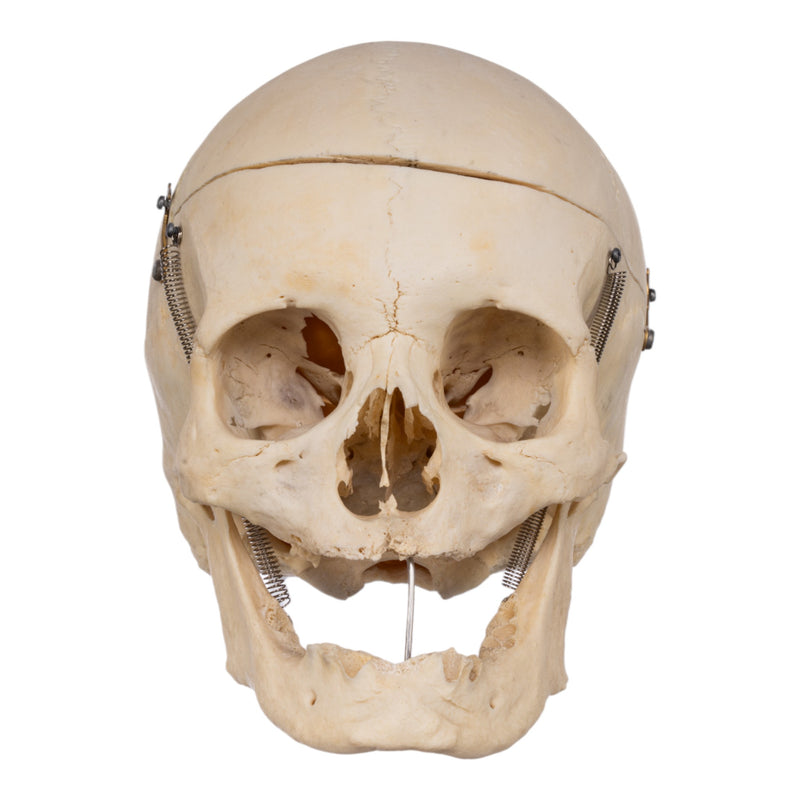Real Human Skull