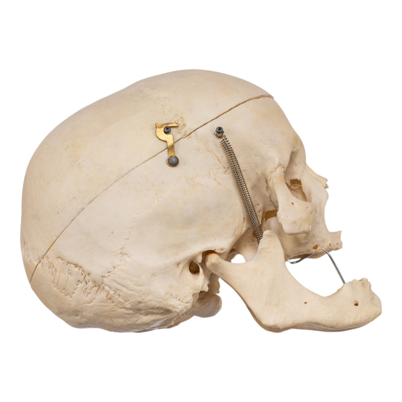 Real Human Skull
