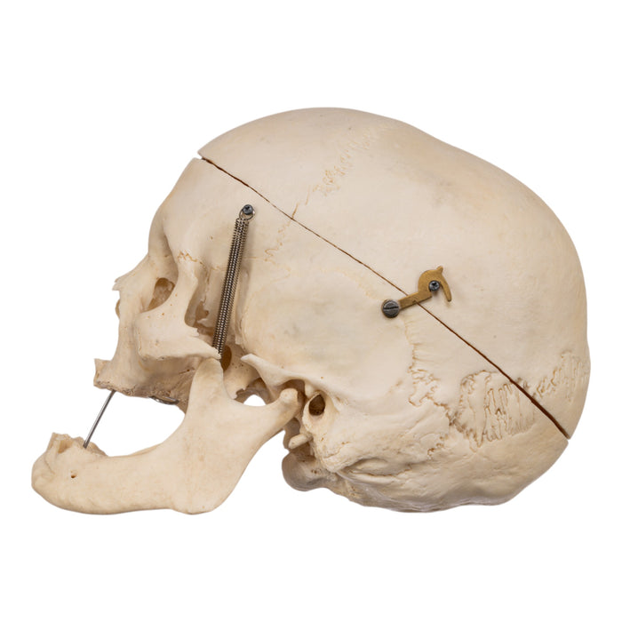 Real Human Skull