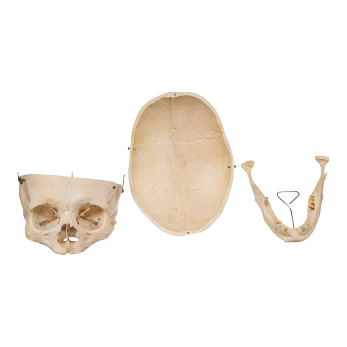 Real Human Skull