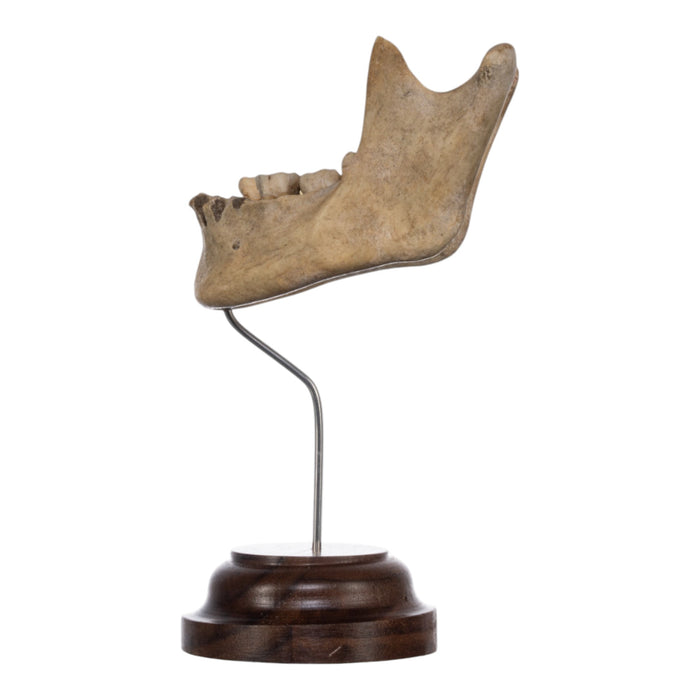 Real Human Mandible on Stand