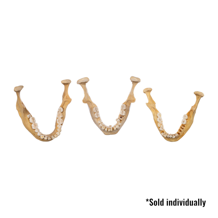 Real Human Mandible - Single