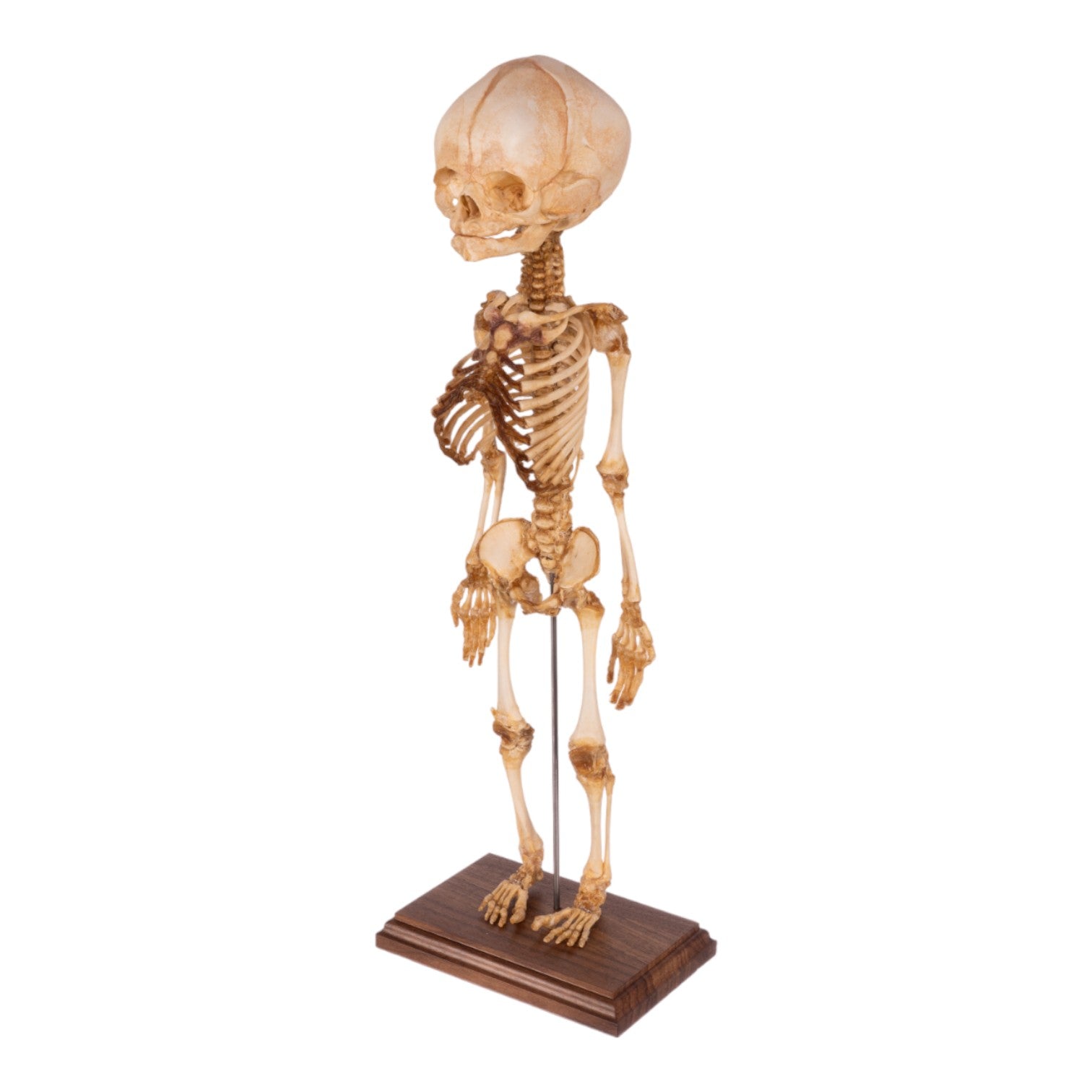 Real Human Fetal Articulated Skeleton For Sale — Skulls Unlimited