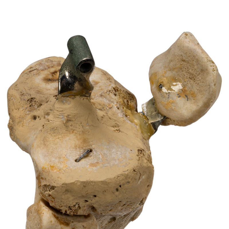 Real Human Right Leg - Partial, Articulated