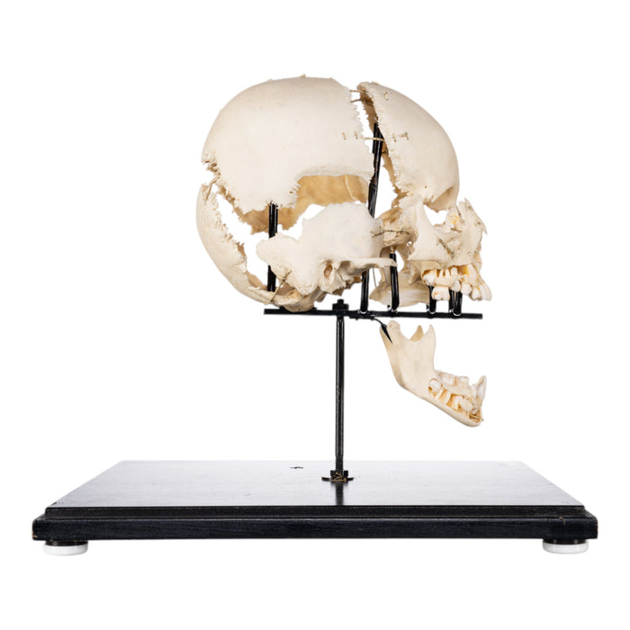 Real Human Exploded Skull on Stand