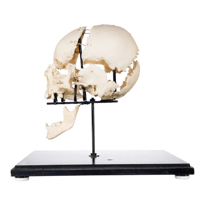 Real Human Exploded Skull on Stand