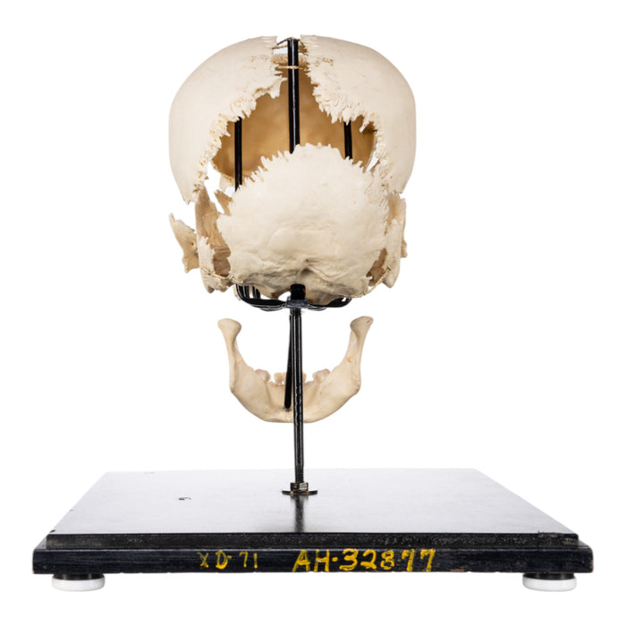 Real Human Exploded Skull on Stand