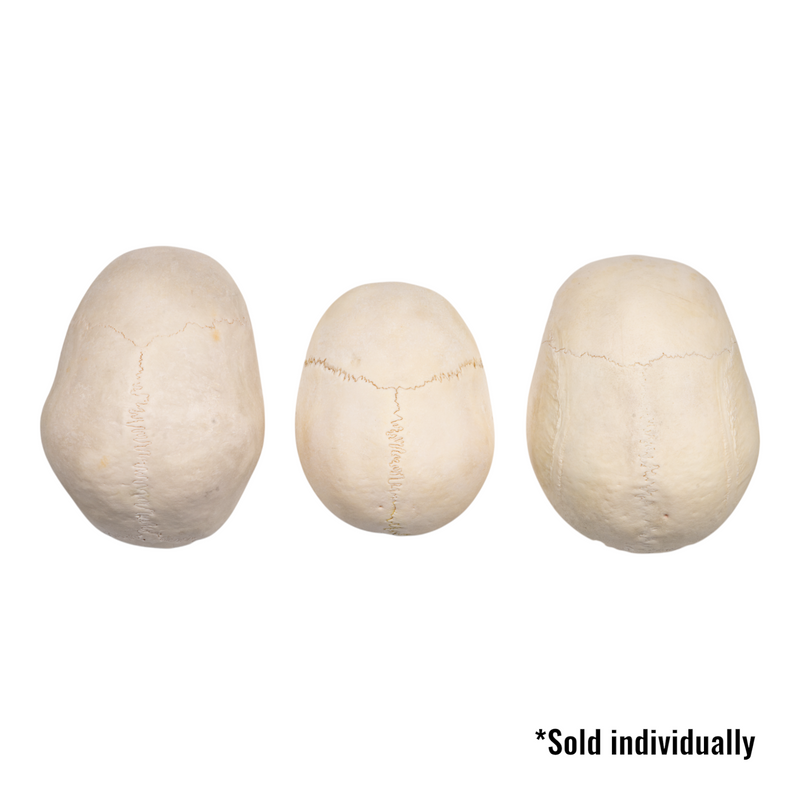 Real Human Calvaria - Single