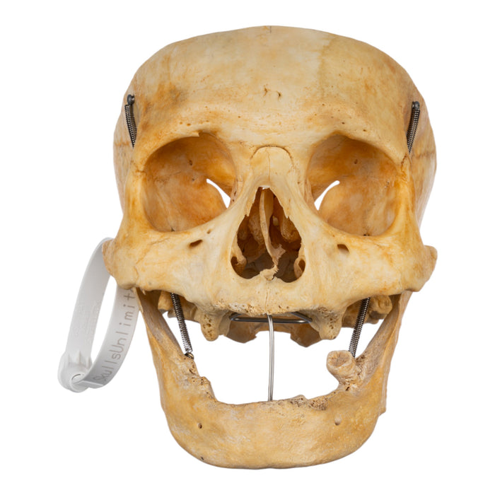 Real Human Skull - Partial