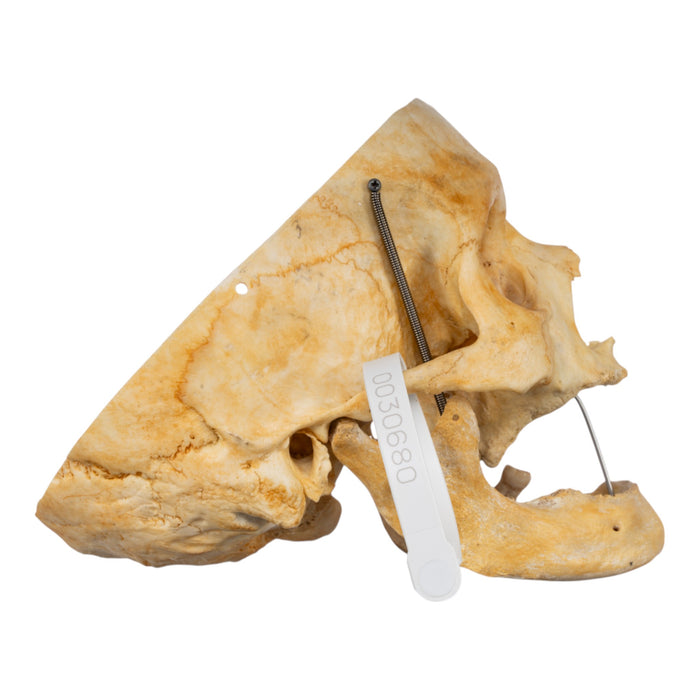 Real Human Skull - Partial