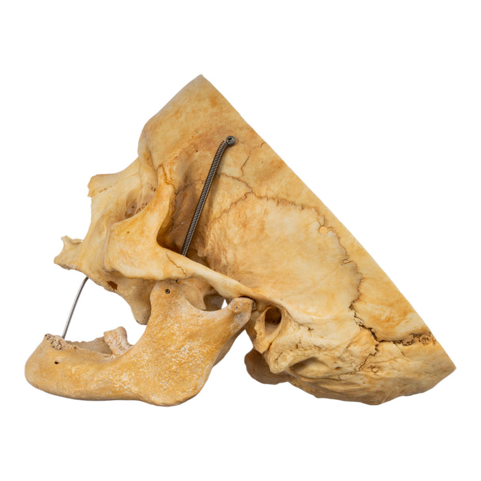Real Human Skull - Partial